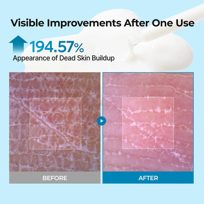 Exfoliating TX Serum