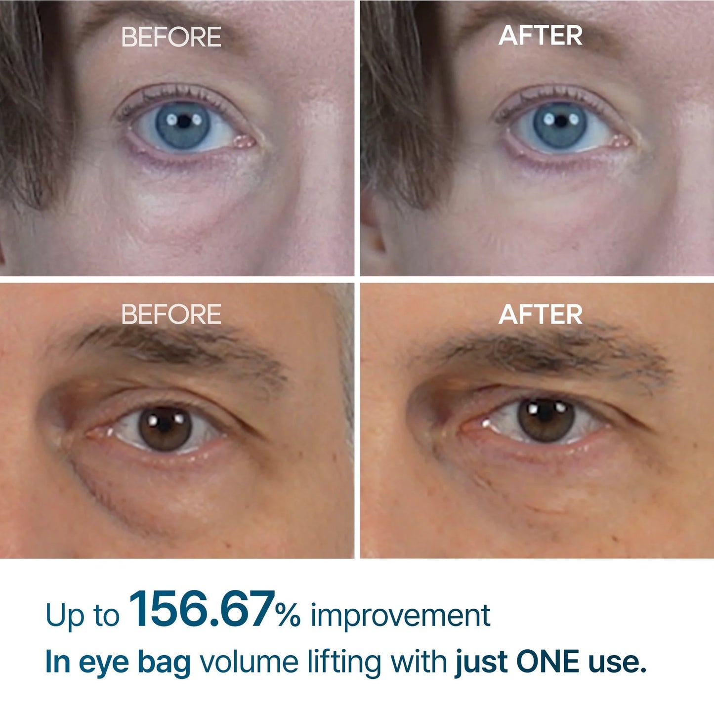 eyebag cream