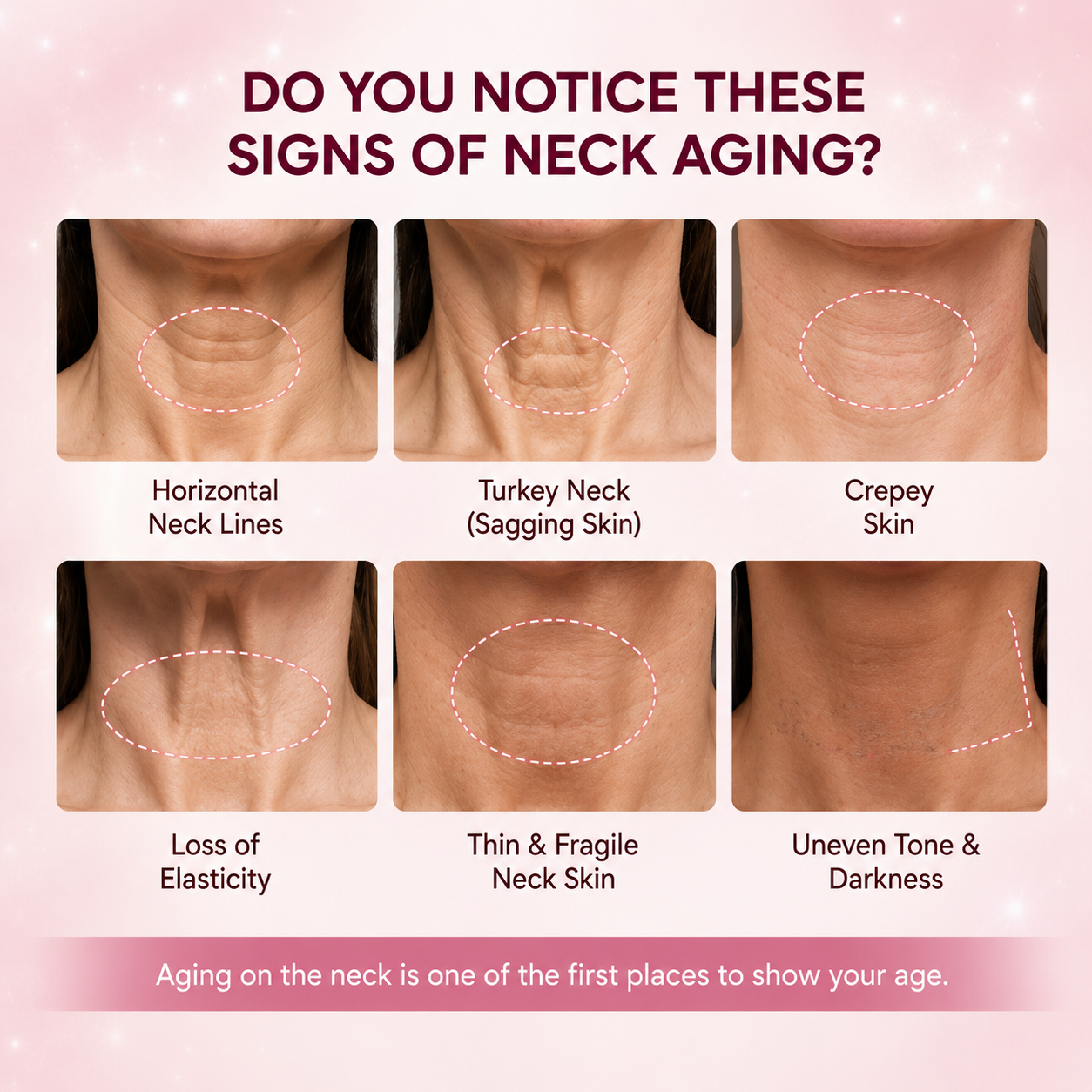 Perfect Neck Wrinkle Care Set